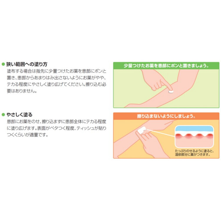 【指定第2類医薬品】リンデロンＶｓ軟膏　５ｇ